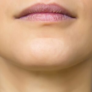 Chin