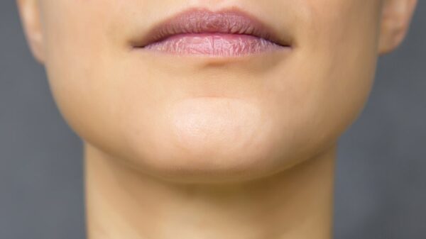 Chin